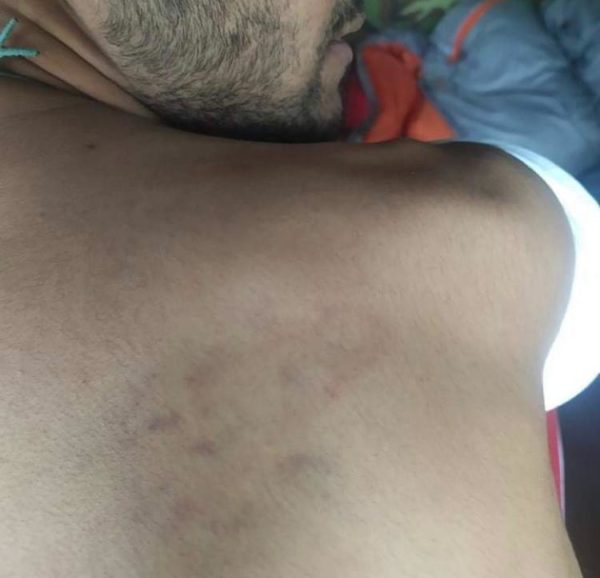 The doctor said to the Slovenian police dont deport this man_2