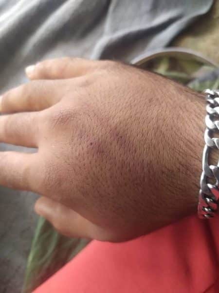 The doctor said to the Slovenian police dont deport this man_3