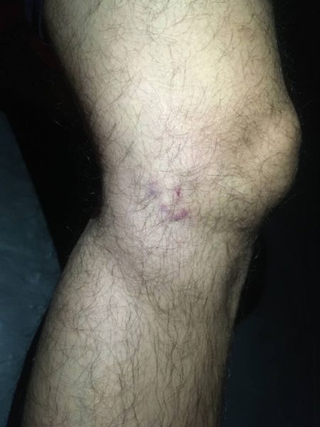 I m scared for this 2