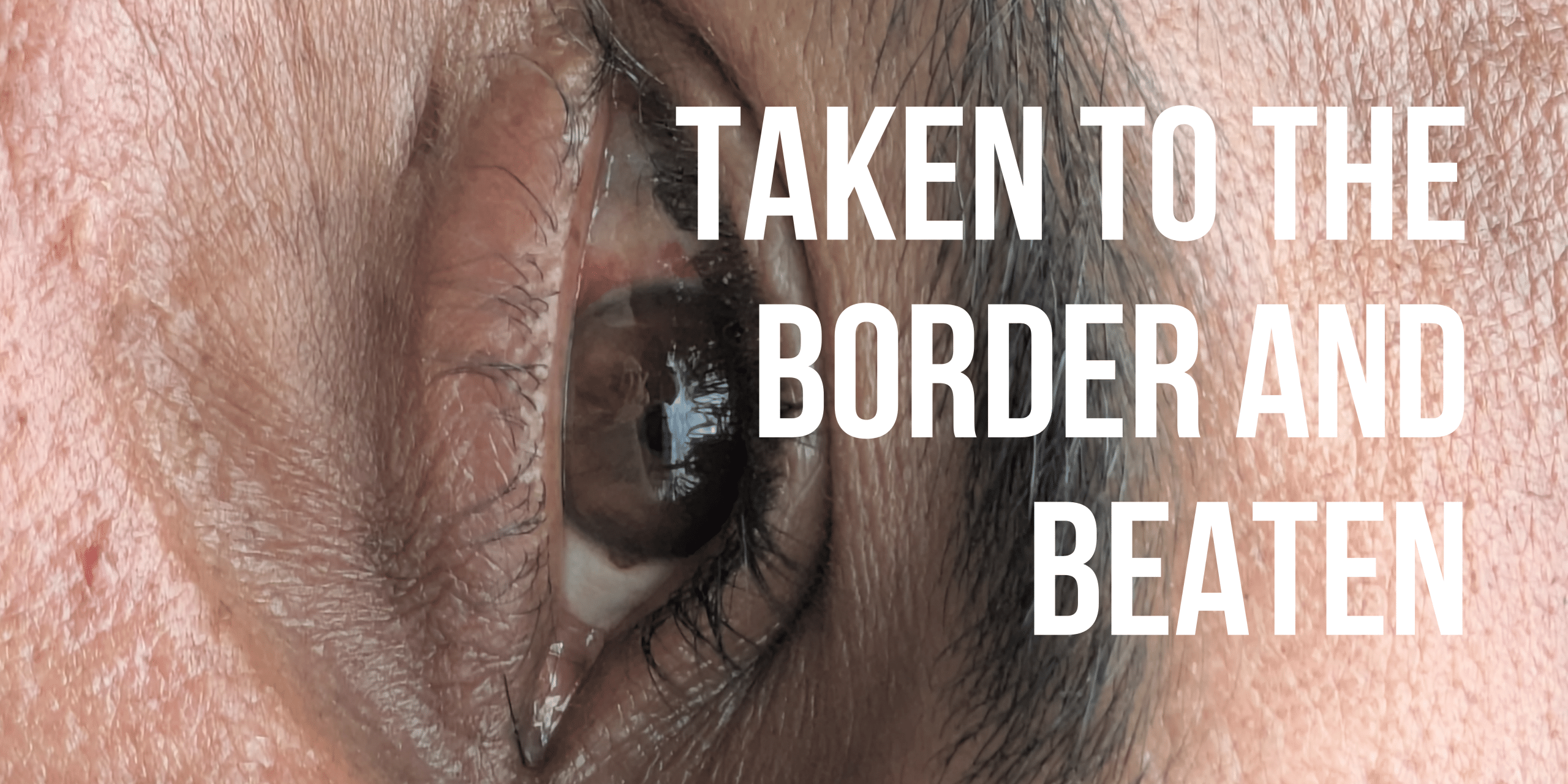 LIVE Bloody borders testimonies(9)