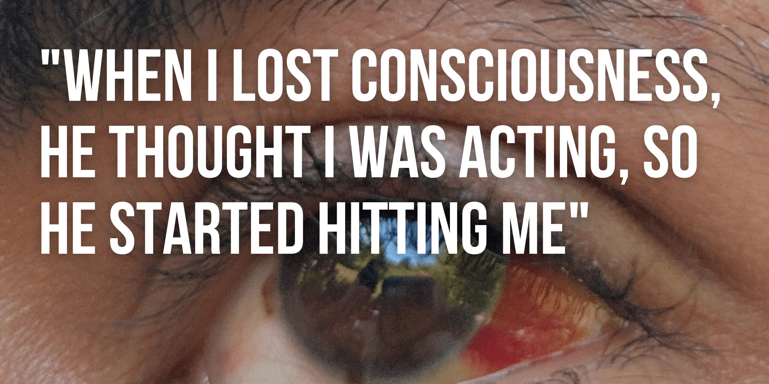 LIVE Bloody borders testimonies(19)