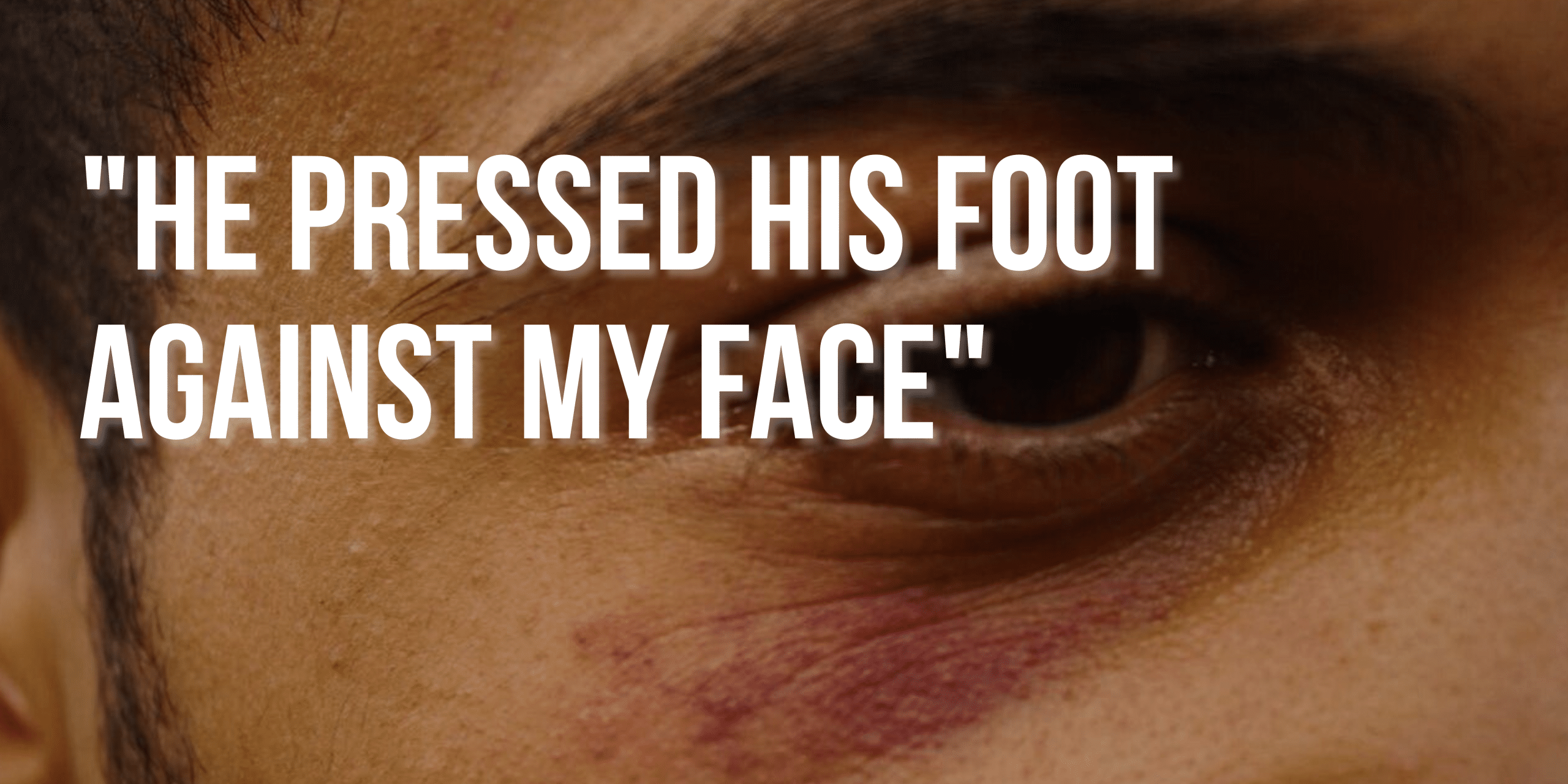 LIVE Bloody borders testimonies (11)