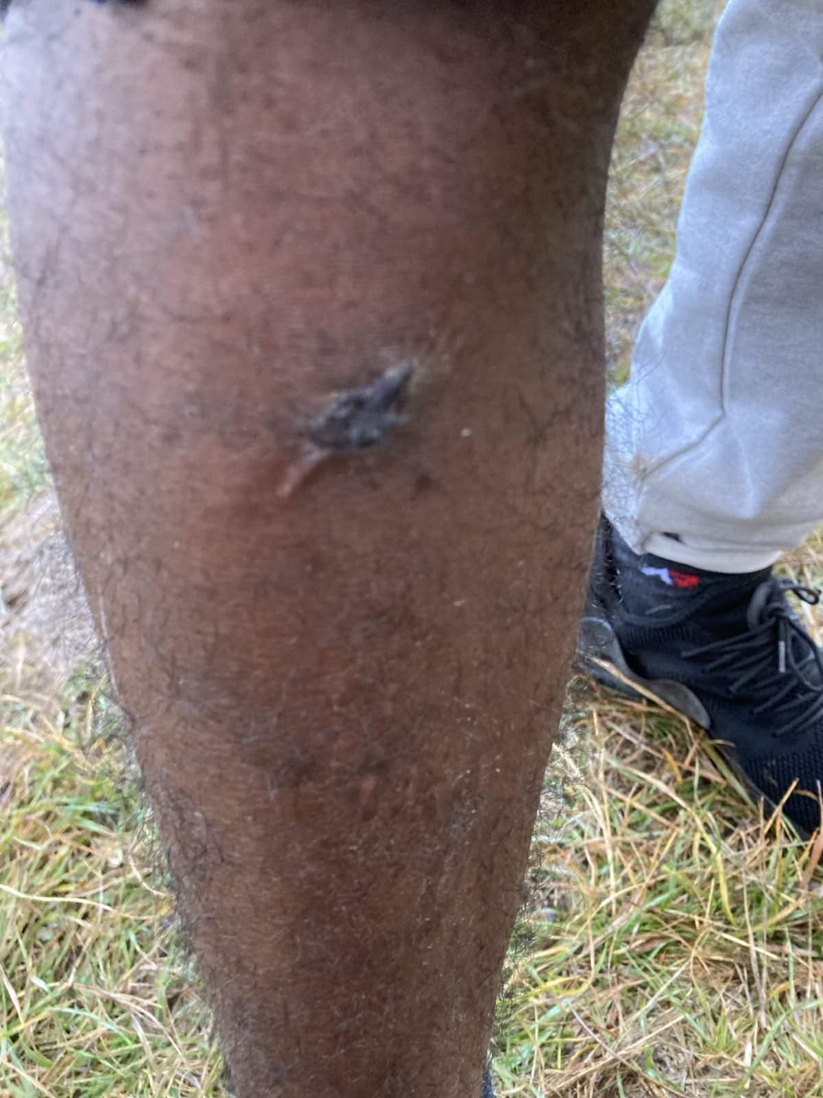 “They broke his finger and burned his face” Five men beaten, robbed, and forced back to Bosnia