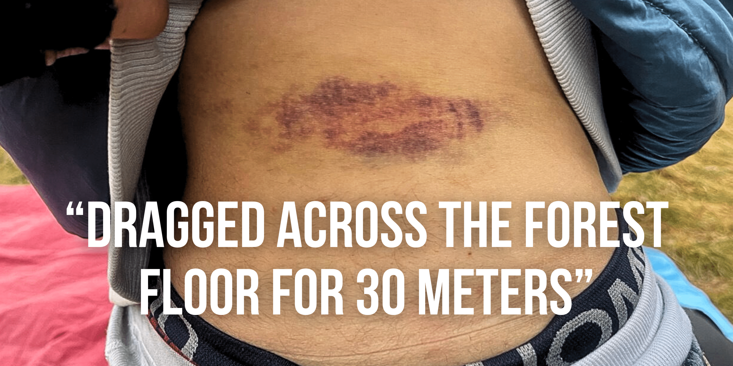 LIVE Bloody borders testimonies (4)