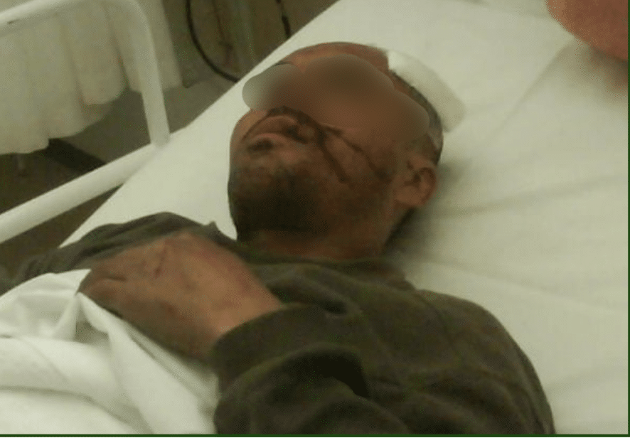 I ran away very fast so they beat me very little2