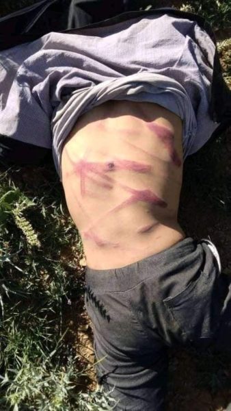 I ran away very fast so they beat me very little3