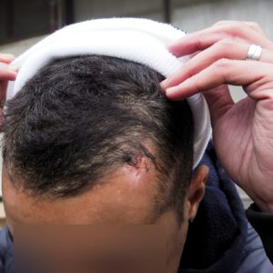 One of the officers began to hit the respondent with a baton2