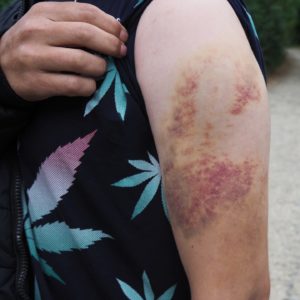 You have Euro? Give me money2