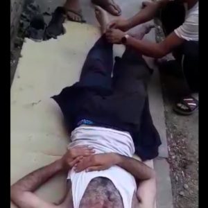 Hospitalized for 7 days after severe violence2