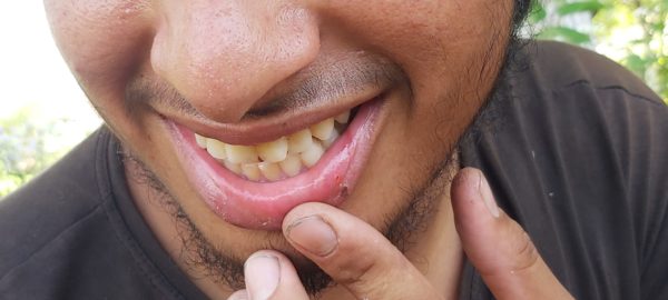 They put the spray on us and police told us to go down2